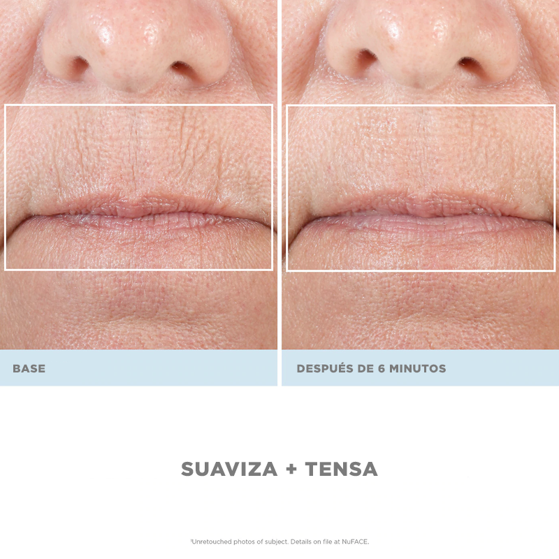 NuFACE The Petite Facial Kit