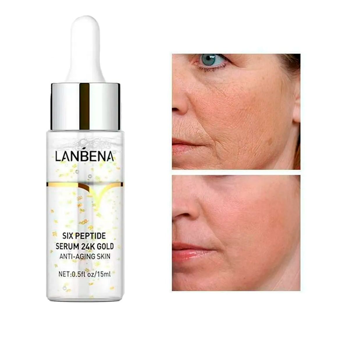 Colágeno Vitamina C Ácido Hialurónico Anti-Acne Set Facial 5 Piezas Antiedad