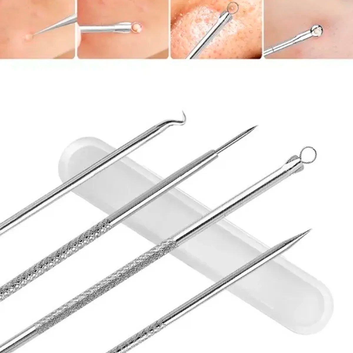 Removedores De Puntos Negros Espinillas,Vaporera Facial Mas Utensilios