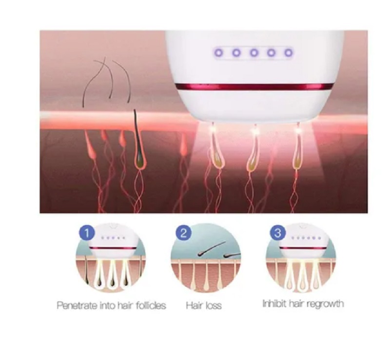 Depiladora Láser Ipl Profesional De 500.000 Pulsos