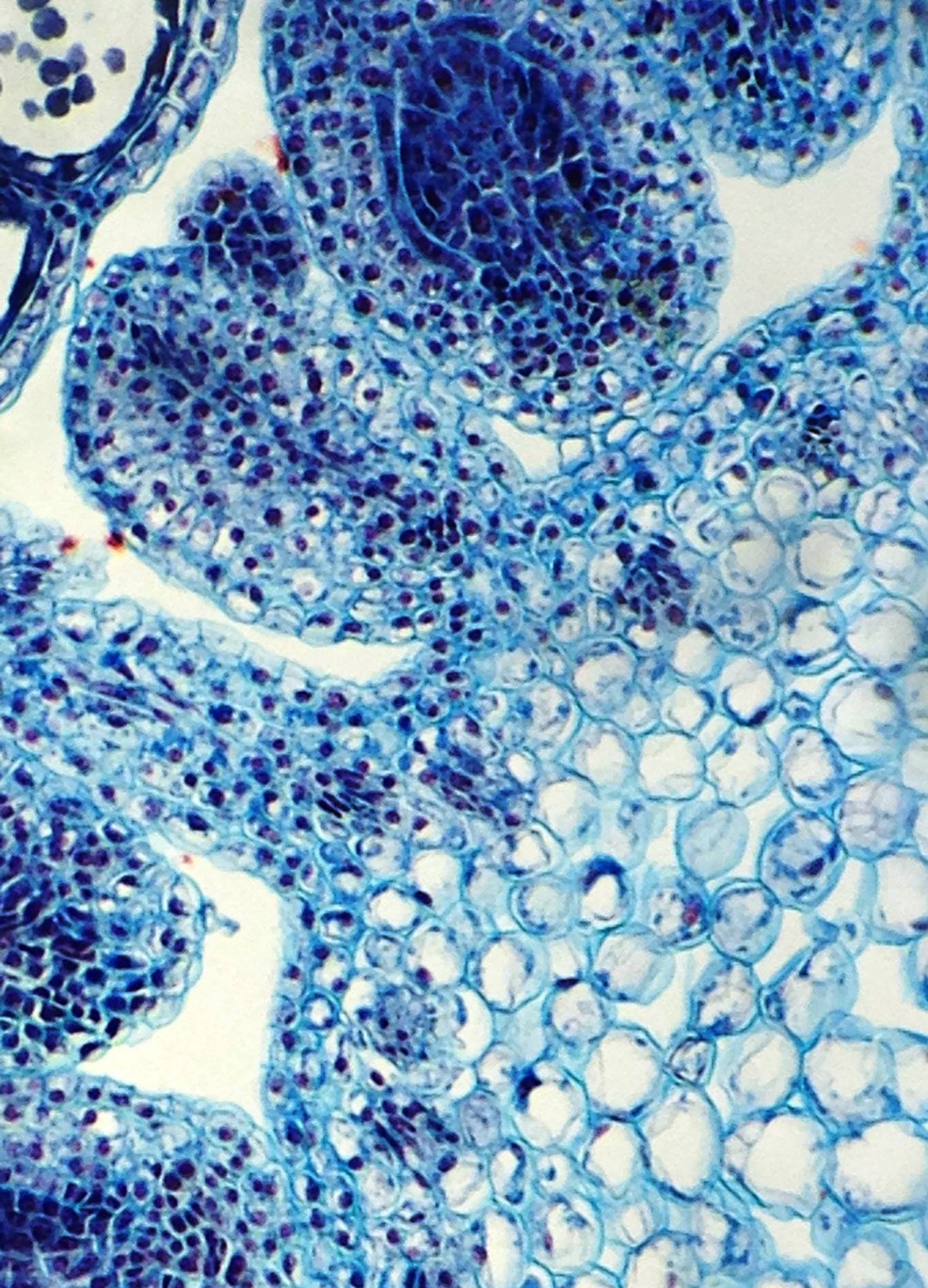 Microscopio De Bolsillo 100-250x Carson Microflip