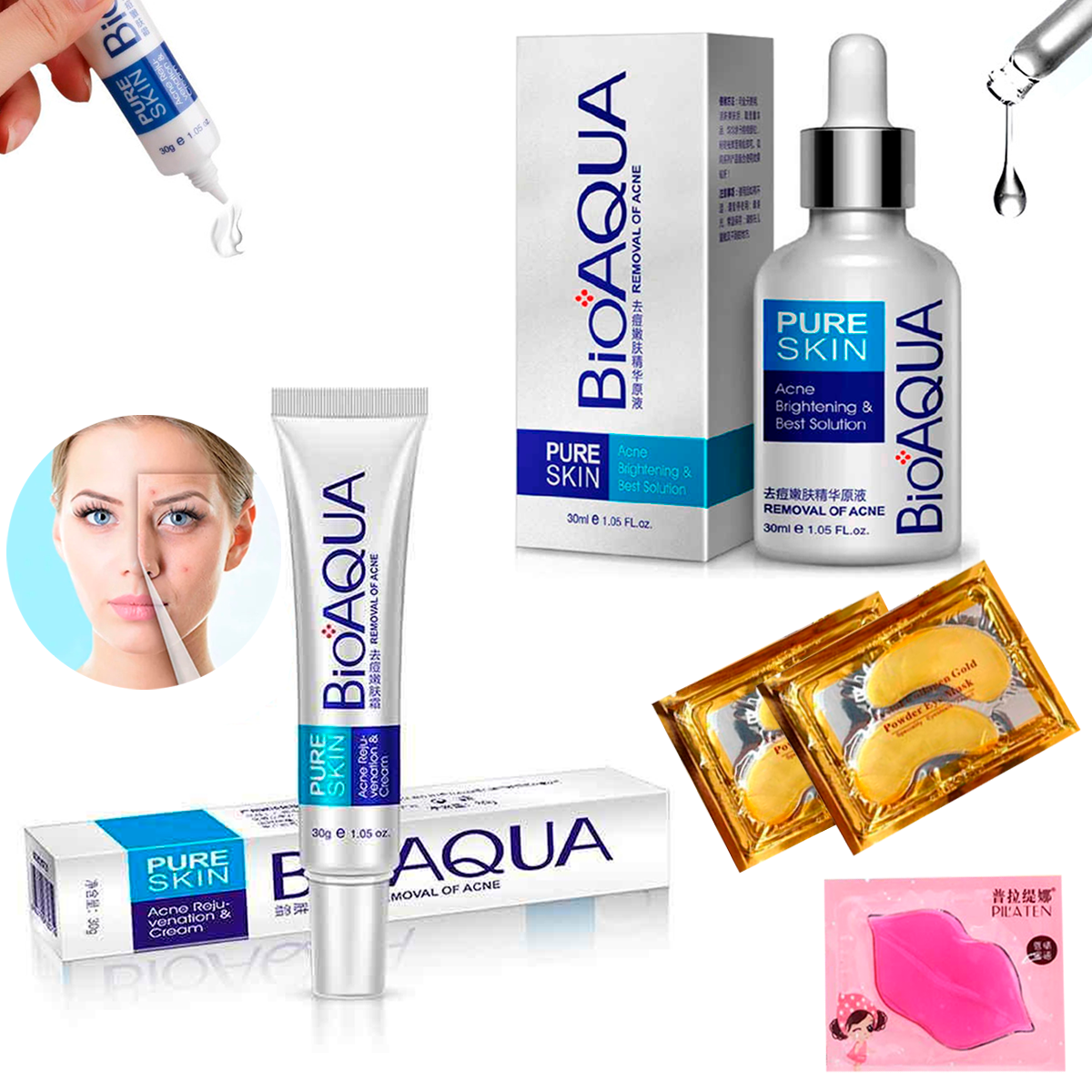 Removedor de Acné Serum y Crema Tratamiento Anti-Acné Puntos Negros, acido hialuronico