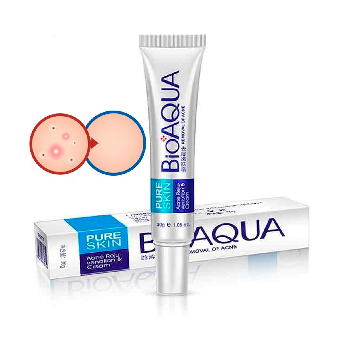 Removedor de Acné Serum y Crema Tratamiento Anti-Acné Puntos Negros, acido hialuronico