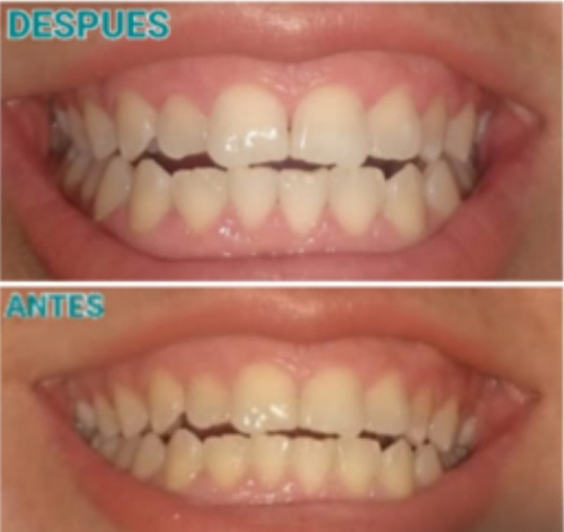 Pasta Dental by Farmasi Blanqueadora Quitamanchas Limpieza Profunda