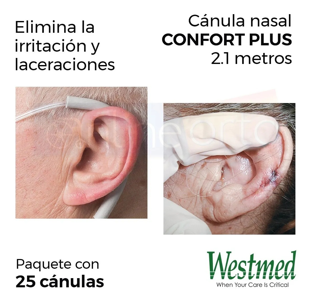 Punta/canula Nasal Confort Plus 2m Paq. 25 Pzas Westmed