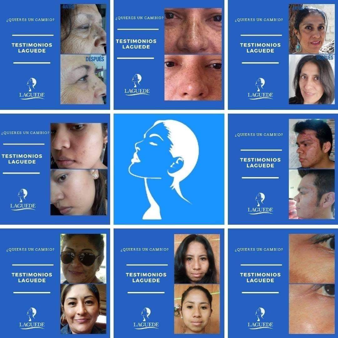 Crema Aclarante+ Despigmentante + Anti-edad de Noche 20g Laguede 3 Piezas Todo tipo de Piel.