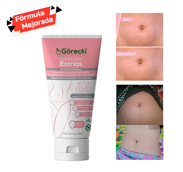 Crema para estrias blancas y rojas Gorecki sin aceite mineral y libre de parabenos
