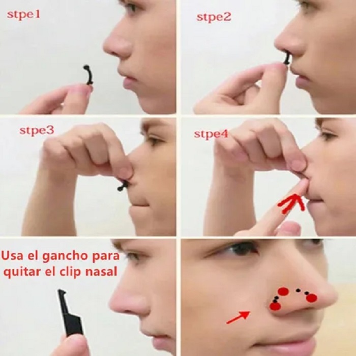 6 Pares Corrector Nasal Respingador Nariz