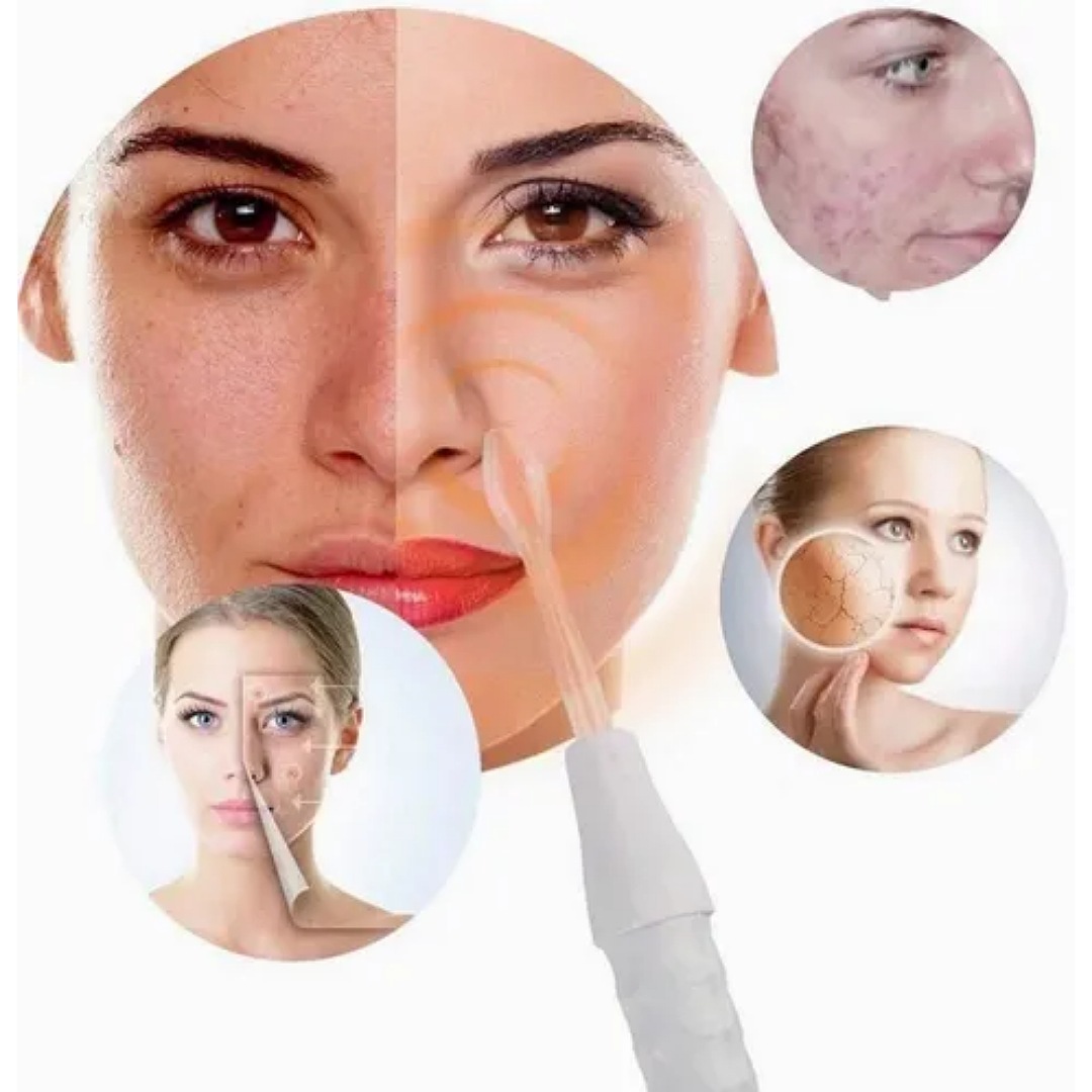 Facial Dispositivos De Alta Frecuencia, Máquina Terapia Piel