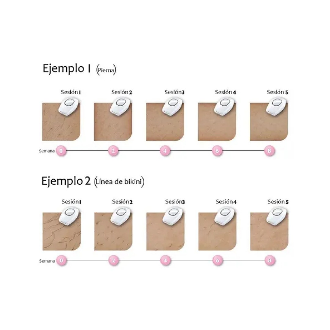 Ipl - Dispositivo De Depilación Láser Permanente 500.000 Des
