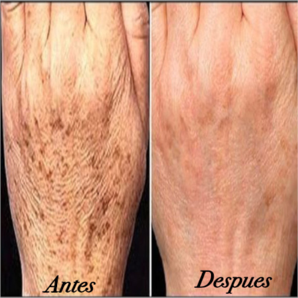 Nu Skin 180 Face Wash Dermolimpiador Aclarante Afirmante