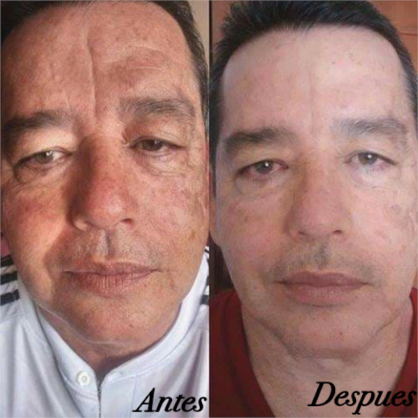 Nu Skin 180 Face Wash Dermolimpiador Aclarante Afirmante