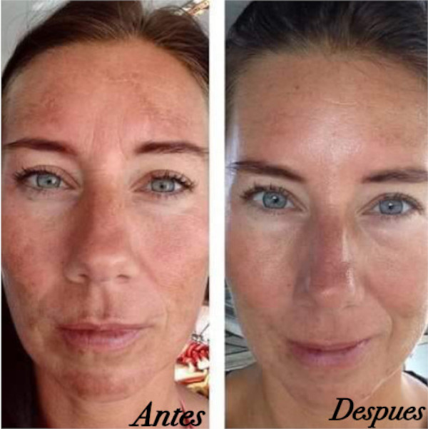 Nu Skin 180 Face Wash Dermolimpiador Aclarante Afirmante