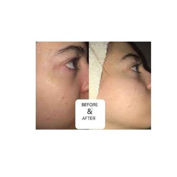 The Ordinary Granactive Retinoid 2% in Squalane