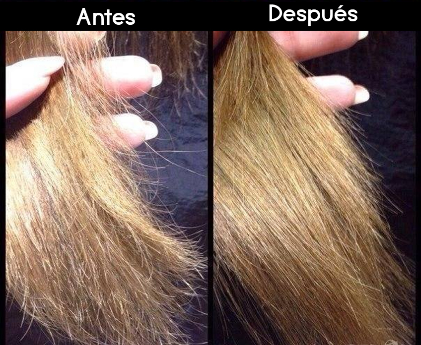 Maquina Quita Orzuela Cabello Maltratado Corta Puntas