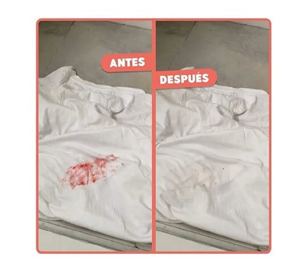 Quitamanchas Bye Bye Manchas Drops Quita Manchas De Textil