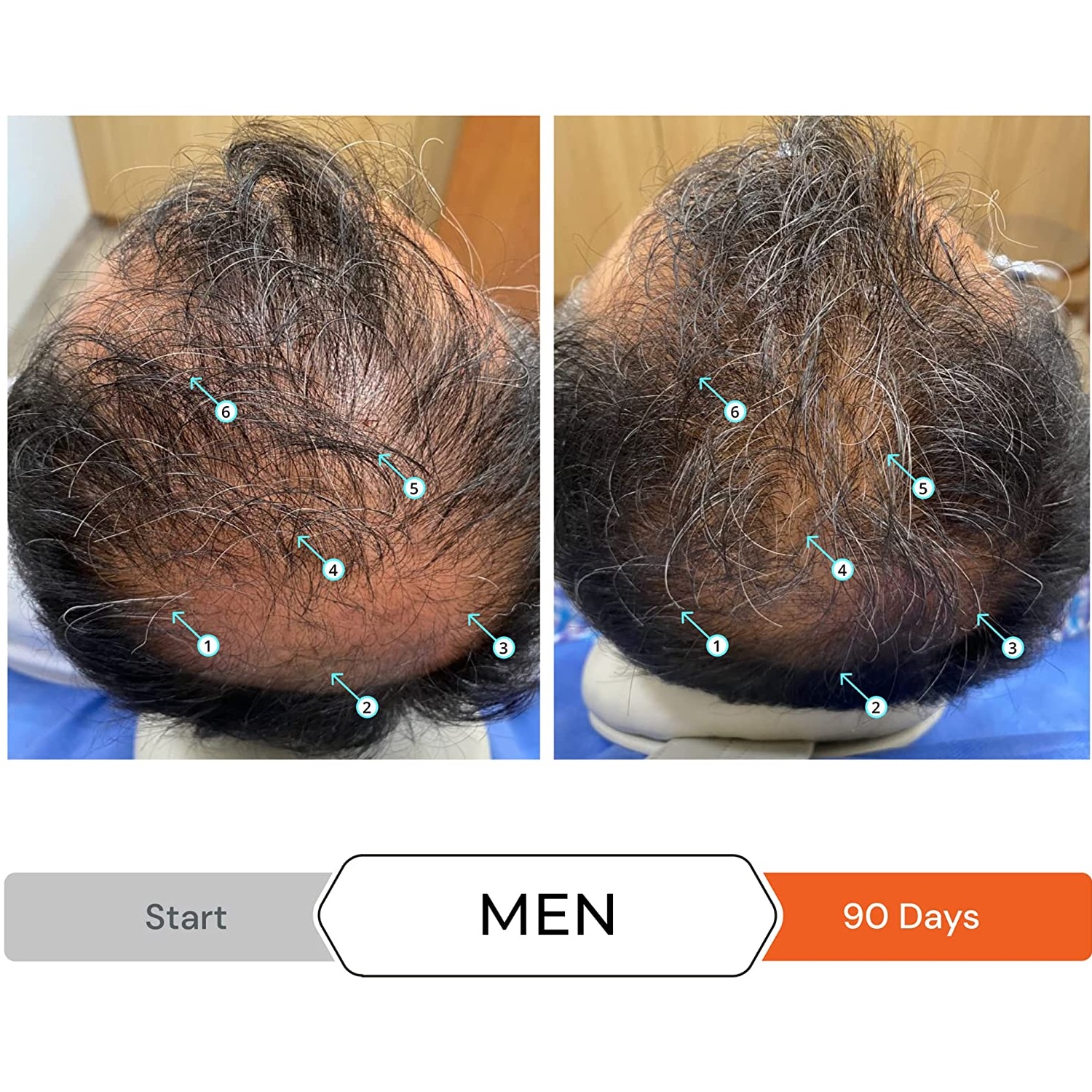 Revita Shampoo Anticaída Y Estimulante Folicular DS Laboratories 925ML