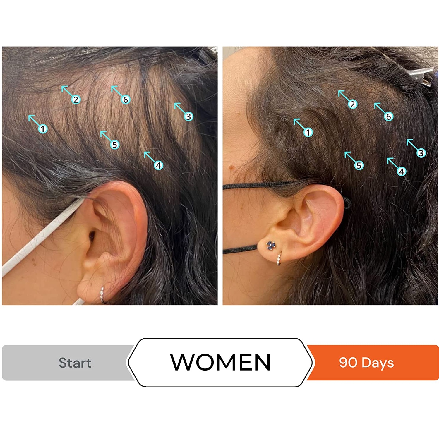 Revita Shampoo Anticaída Y Estimulante Folicular DS Laboratories 925ML