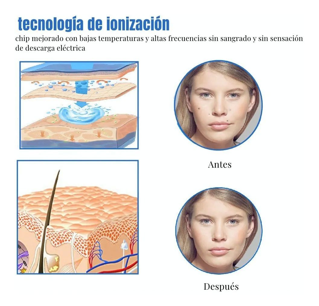 Pluma Cauterizador De Quita Verrugas Pecas Lunares Blanca con Rosa