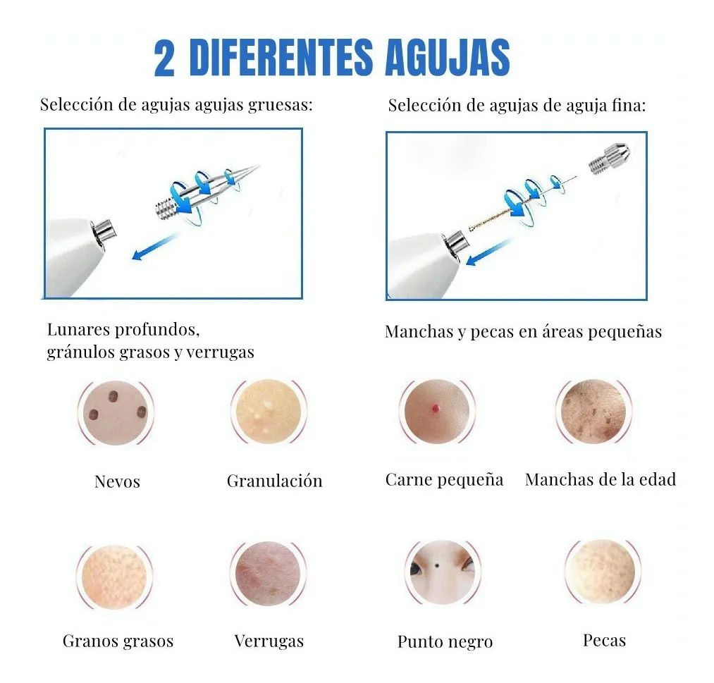 Pluma Cauterizador De Quita Verrugas Pecas Lunares Blanca con Rosa