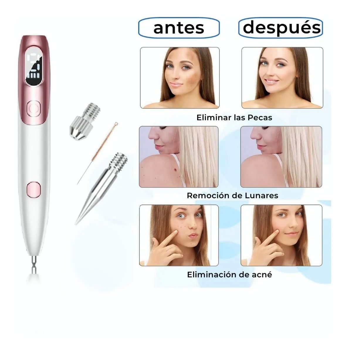Pluma Cauterizador De Quita Verrugas Pecas Lunares Blanca con Rosa
