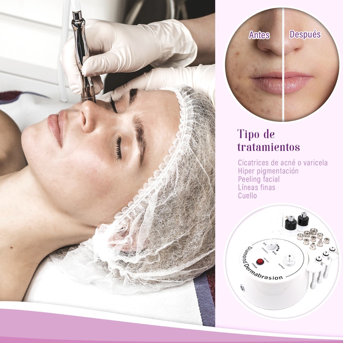 Maquina de  Microdermoabrasion Facial Dermoabrasion 3 en 1 Limpieza  Facial Profesional