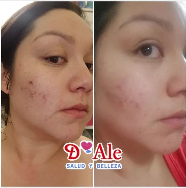 Crema Regeneradora De Células Madre Con Fps 100% Hidratante