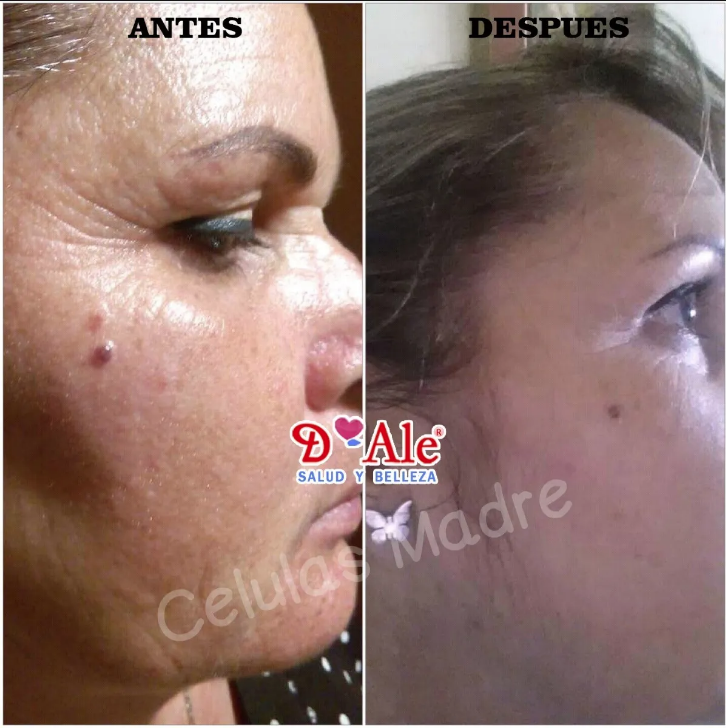 Crema Regeneradora De Células Madre Con Fps 100% Hidratante