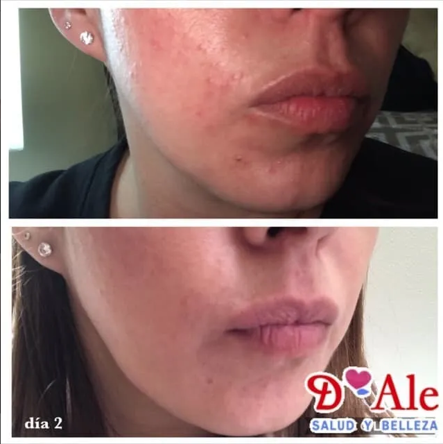 Crema Regeneradora De Células Madre Con Fps 100% Hidratante