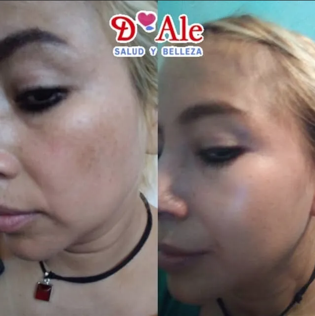 Crema Regeneradora De Células Madre Con Fps 100% Hidratante