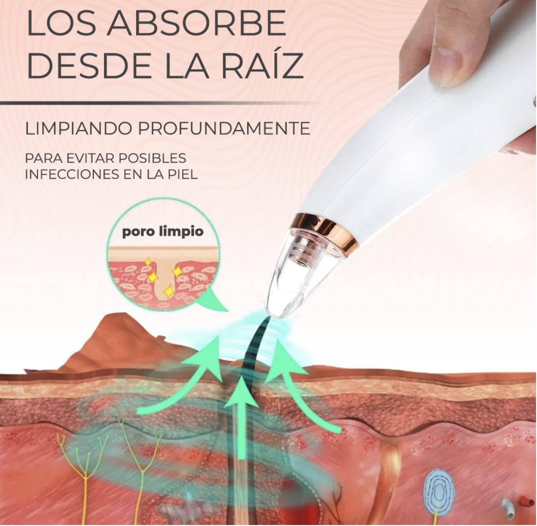 Extractor de Puntos Negros y Limpiador de Poros