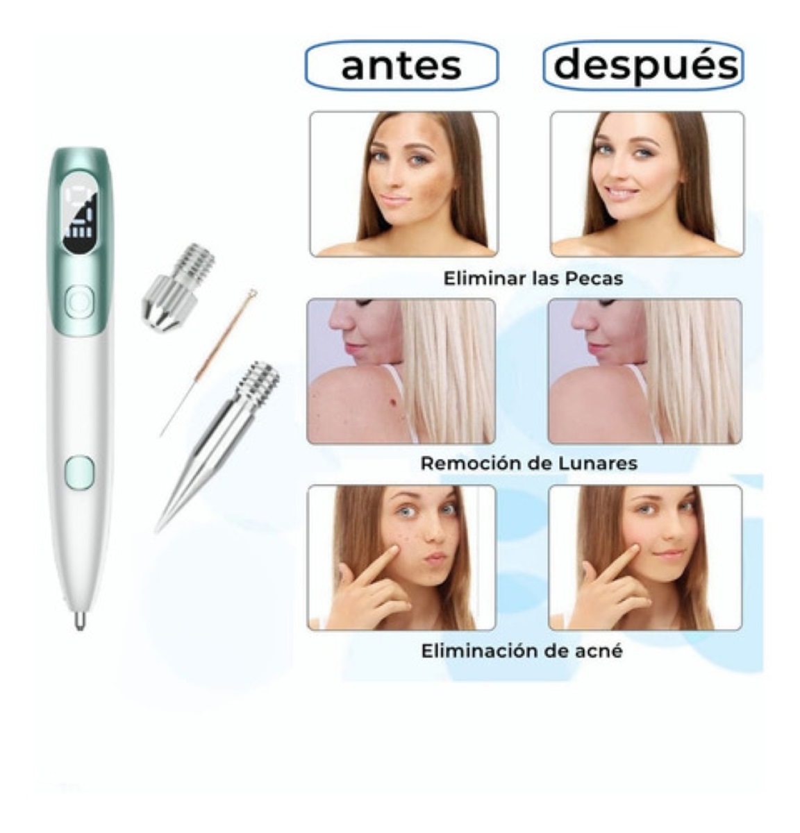 Pluma Verrugas Pecas Lunares Blanco con Verde