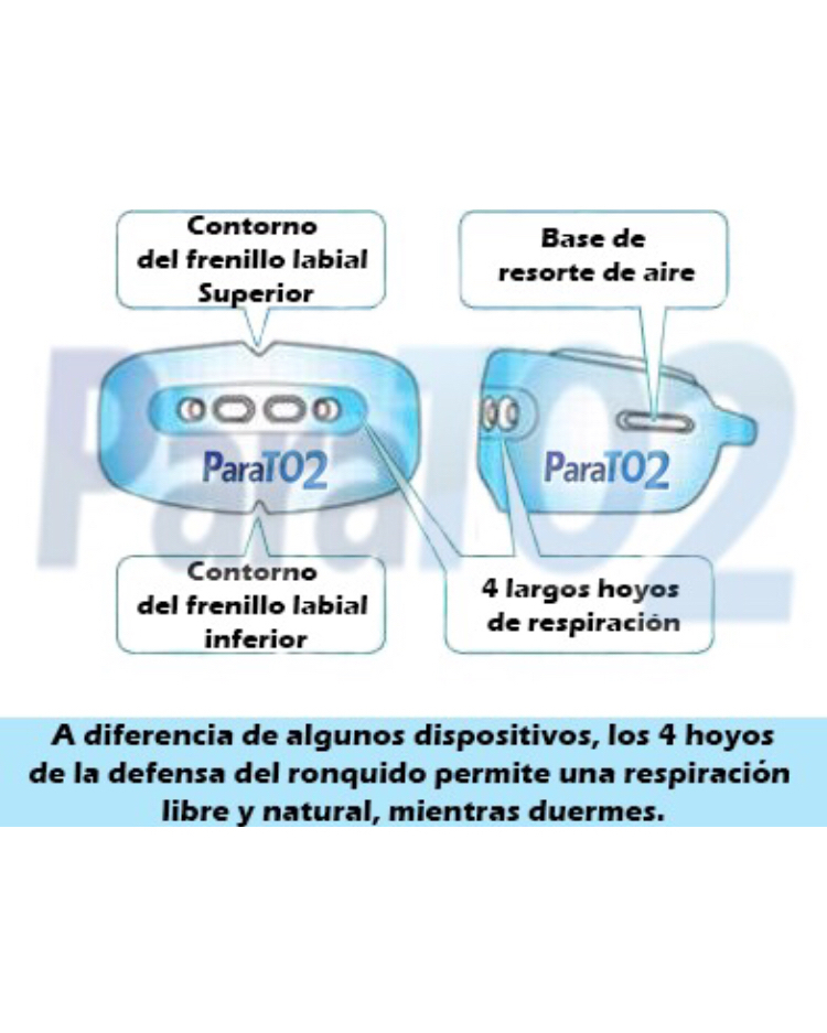 Guarda Bucal Inteligente con Amortiguadores de Aire. Puede Usarse con Brackets. Bruxismo. Anti-ronquido.