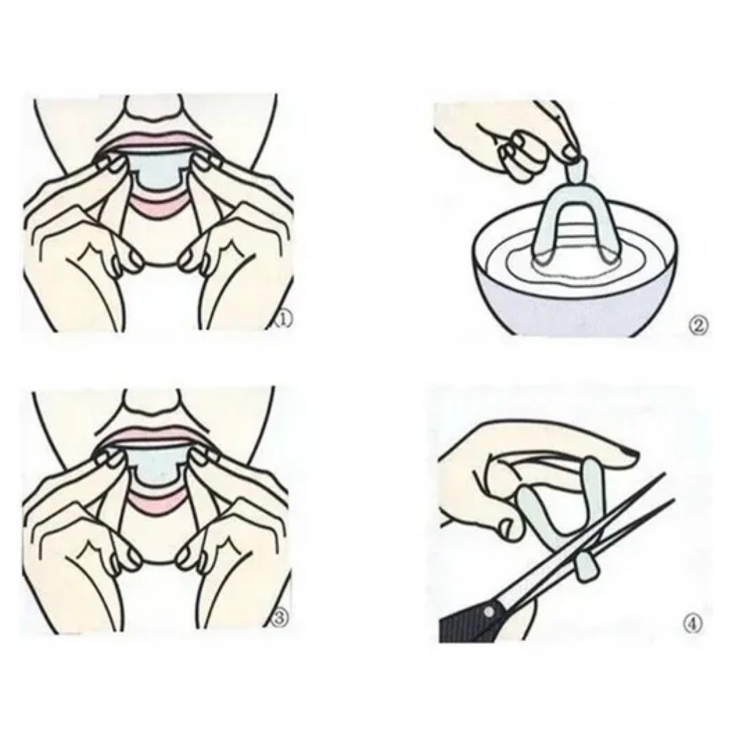 Par Protectores Bucales Guardas Dentales De Gel Moldeables F