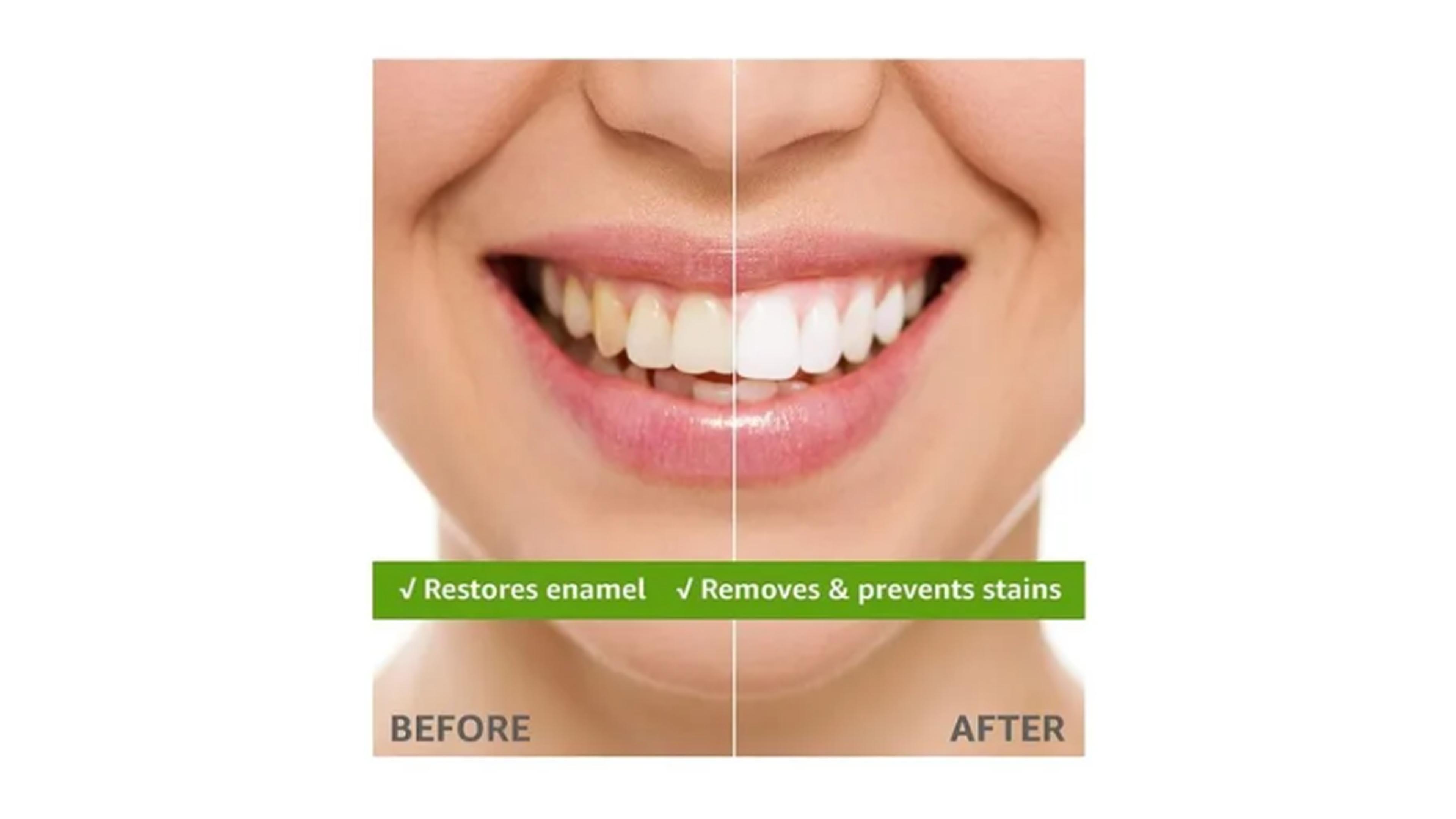 Pasta De Dientes Rembrandt Pasta Dental 2 Pack De 2.6 Oz C/u