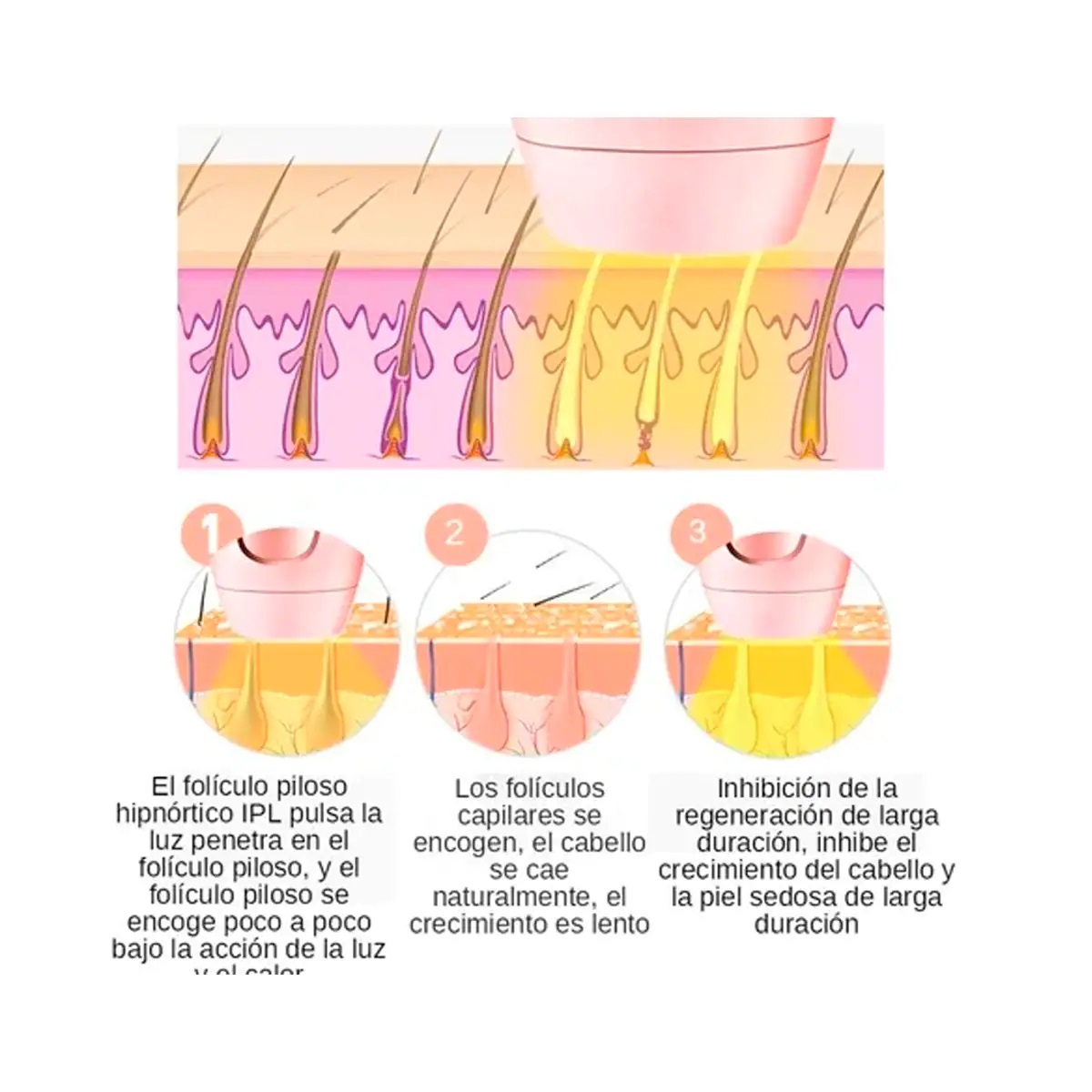 Ipl Depiladora Sin Dolor 600.000 Destellos Láser Permanente