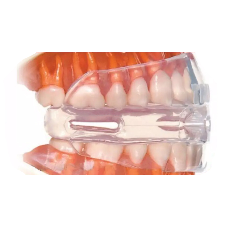 Guarda Bucal Inteligente con Amortiguadores de Aire. Puede Usarse con Brackets. Bruxismo. Anti-ronquido.