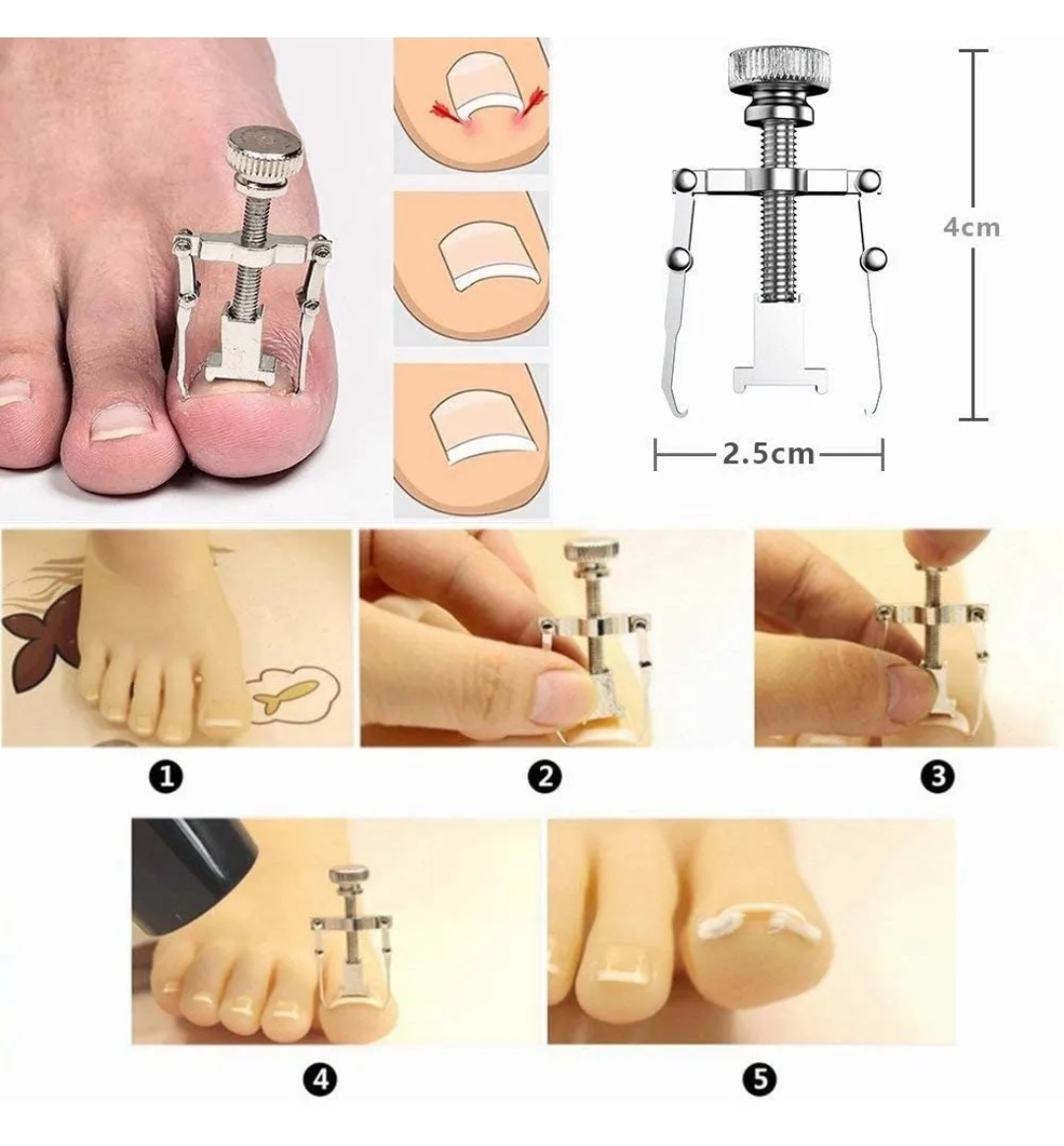 Kit De Herramientas De Uñas Encarnadas Cortauñas Lonk 6pcs