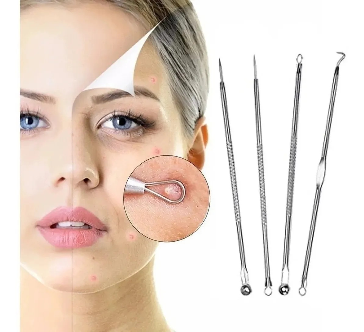 10 kits Removedor Extractor Acne Barros Espinillas 4 piezas.