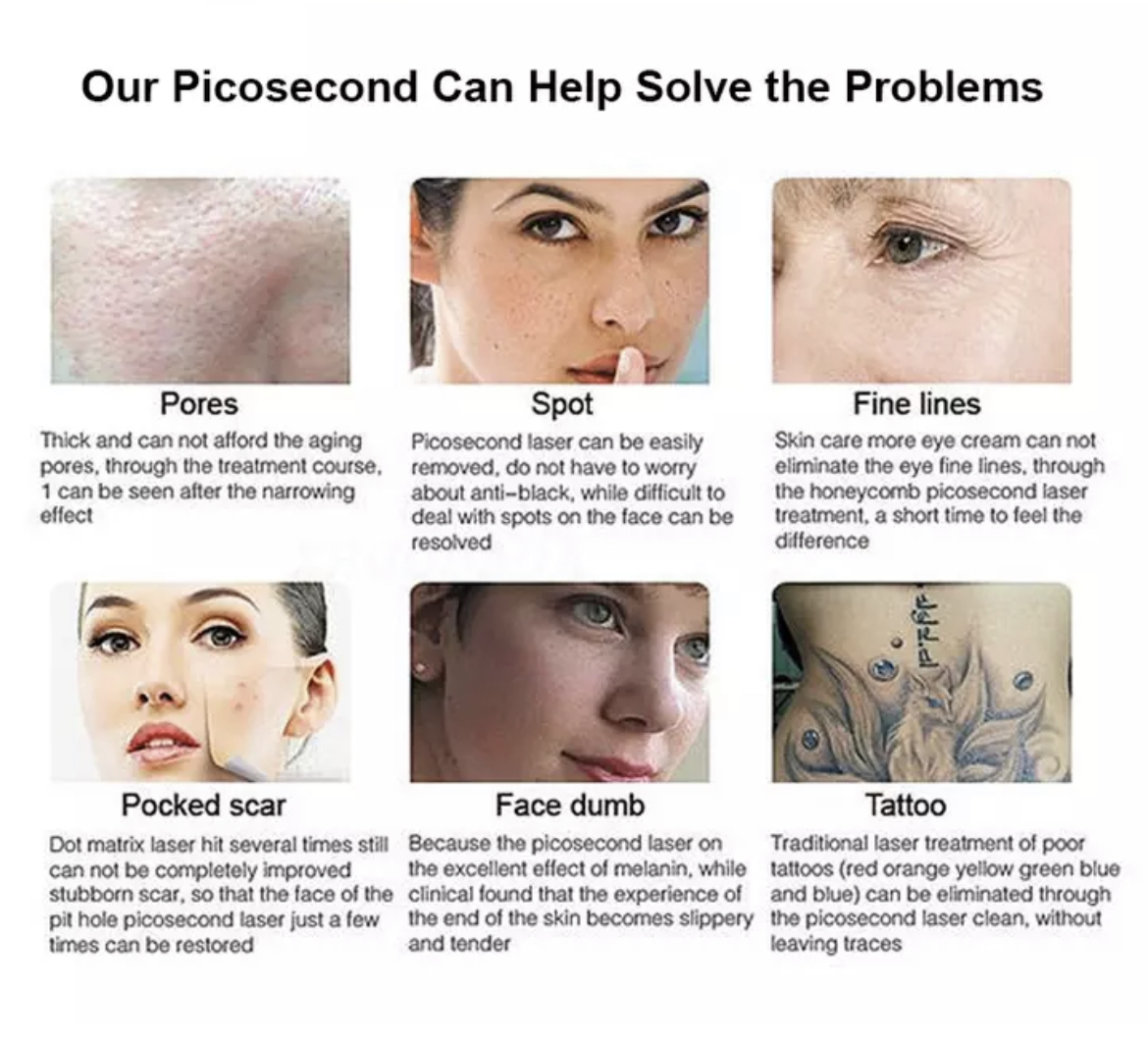 LASER DIODO & PICOSEGUNDO