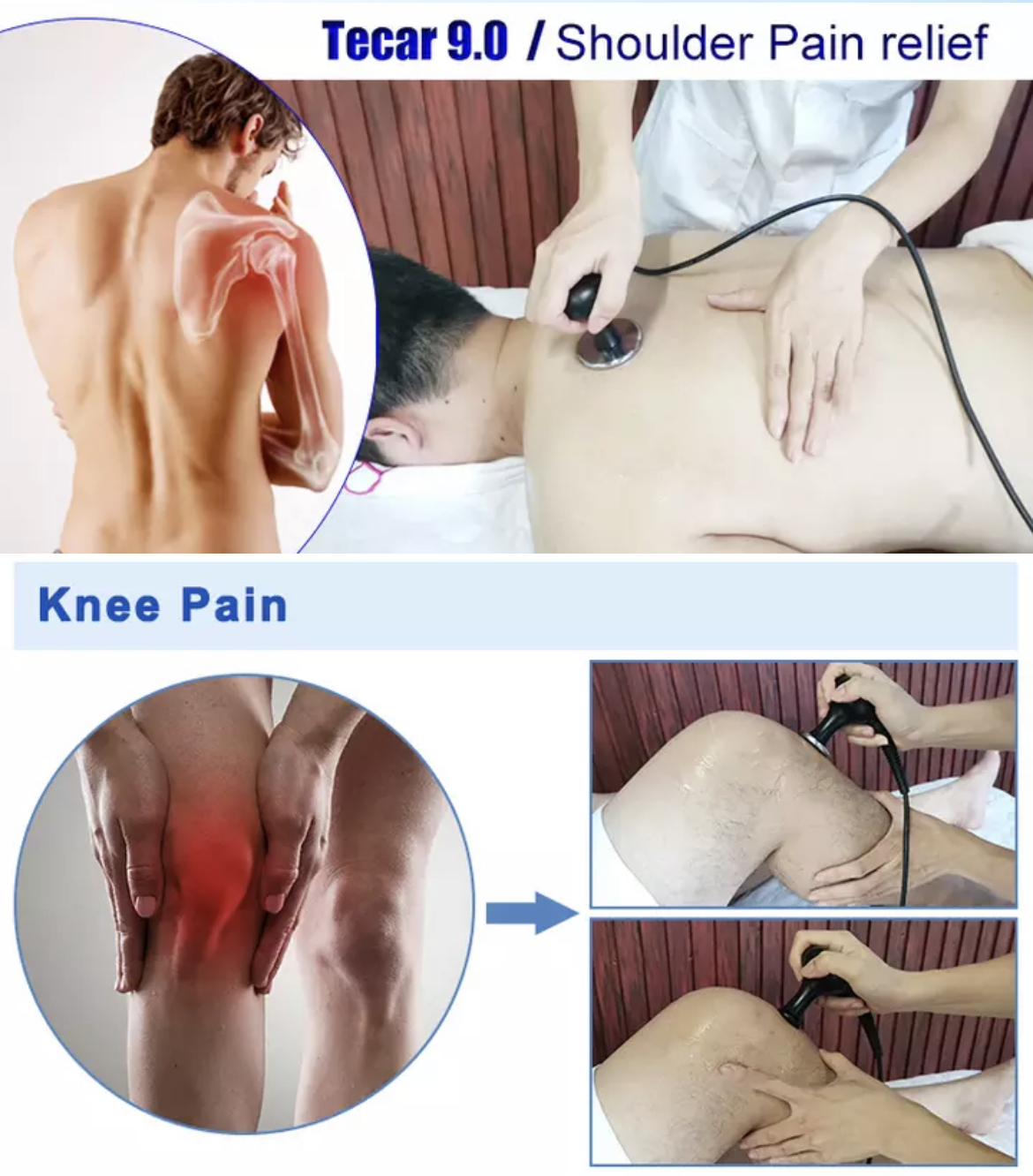 TECARTERAPIA INDIBA RADIOFRECUENCIA CAPACITIVA Y RESISTIVA