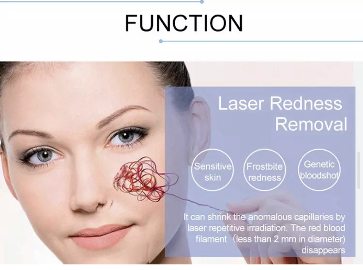 LASER 980 ELIMINACION DE VENAS DE ARAÑA