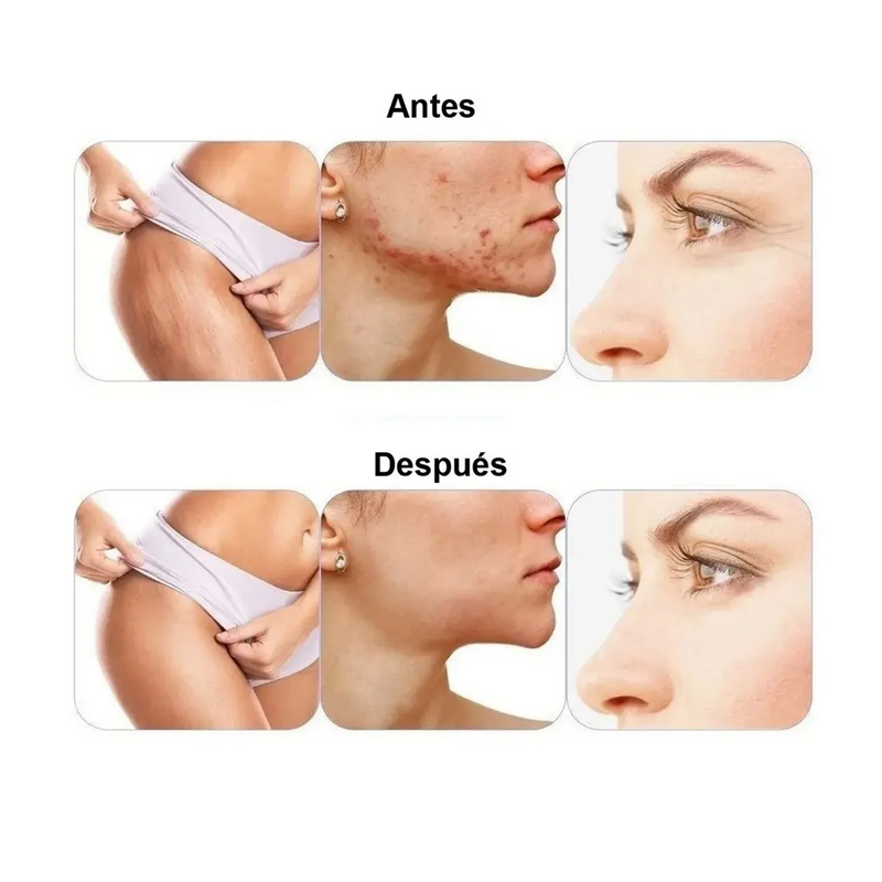 Dermaroller Regenerador Facial Cicatrices Colageno Estrias Rodillo Micropunzante original.