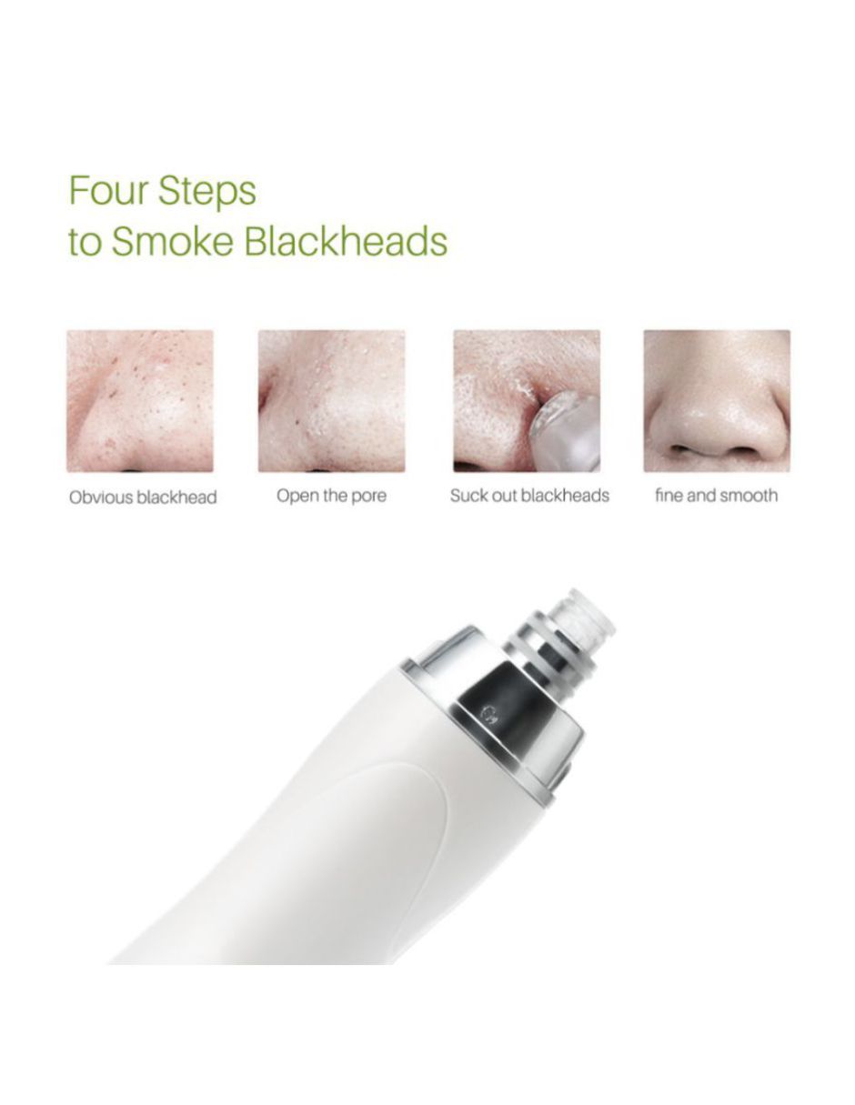 Microdermoabrasión portátil punta diamante Peeling Acne Estrias