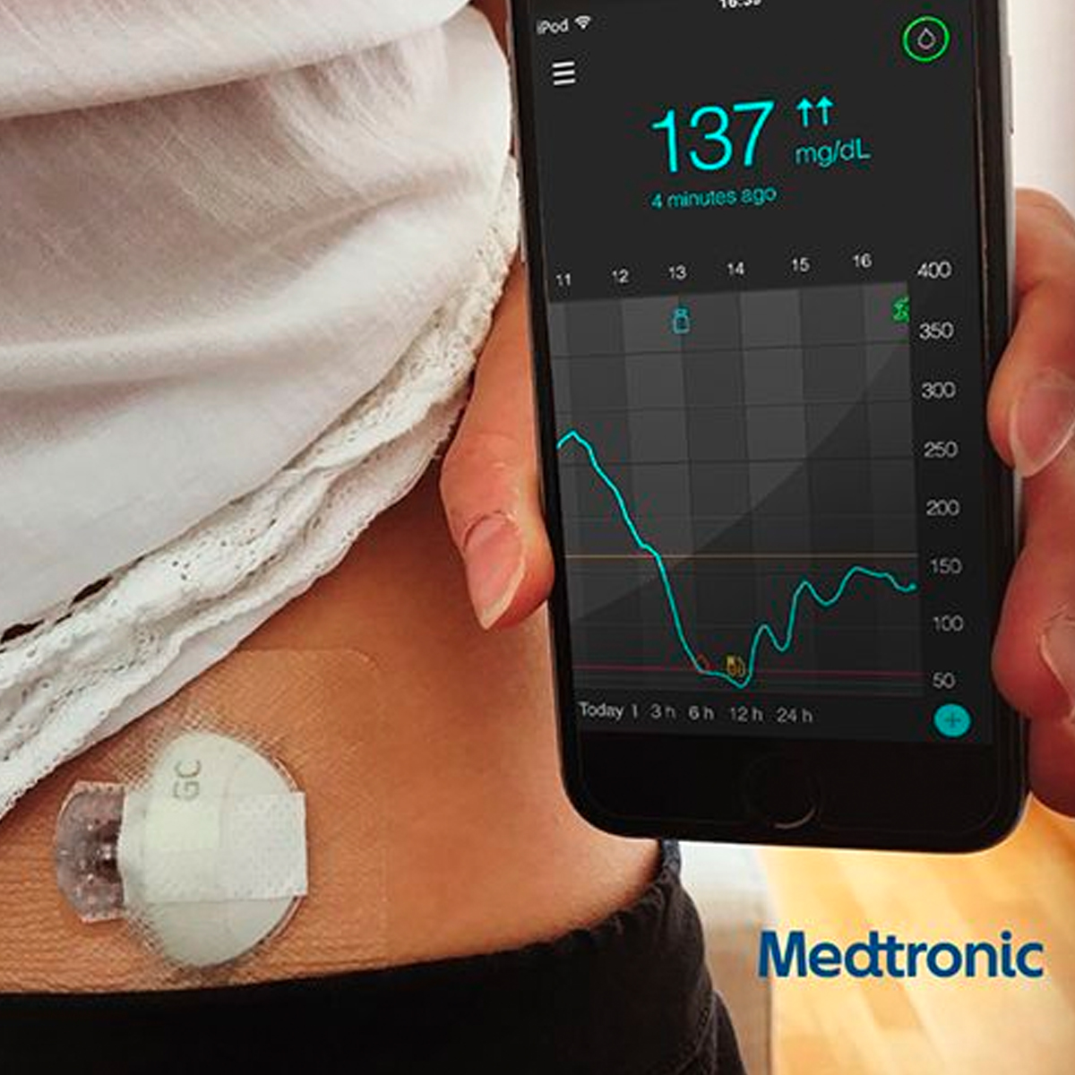 Medtronic Guardianconnect Monitor Continuo Glucosa Kit