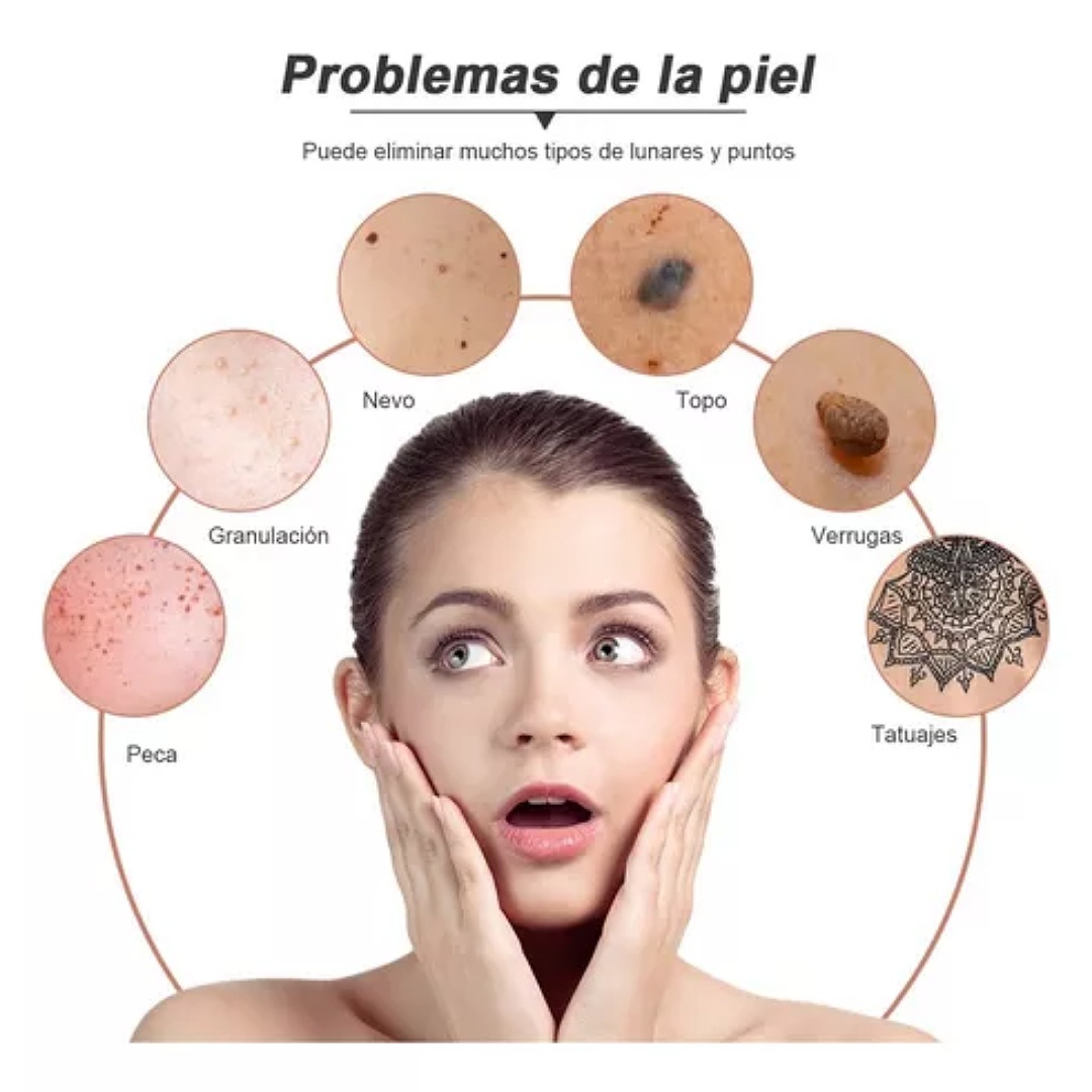 Herramienta Para Quitar Verrugas Ciicii Pluma Cauterizador por CIICII