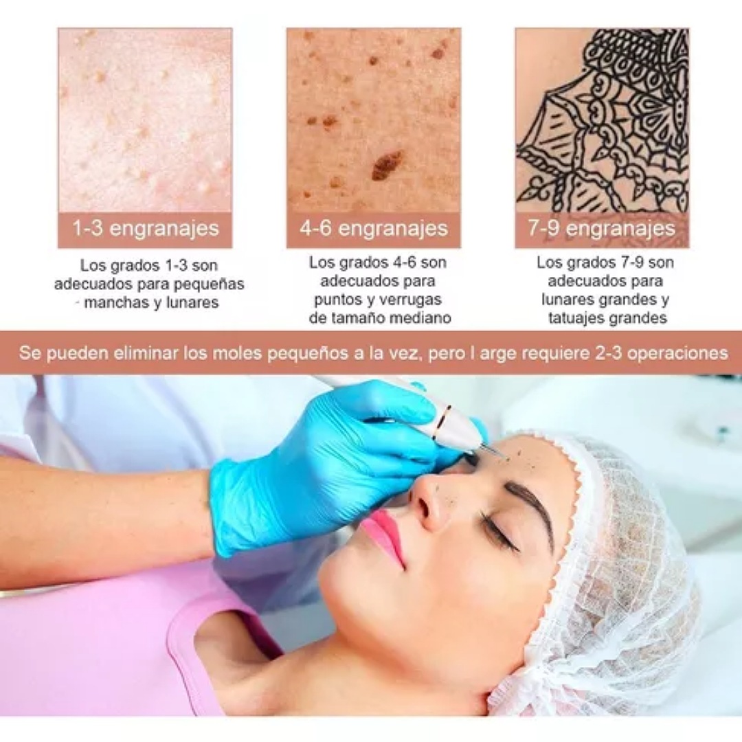 Herramienta Para Quitar Verrugas Ciicii Pluma Cauterizador por CIICII