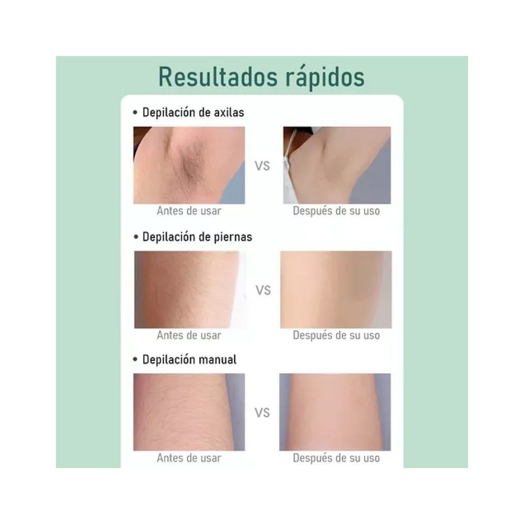 Depiladora Láser Ipl Pulsada Permanente Para Cuerpo Y Cara