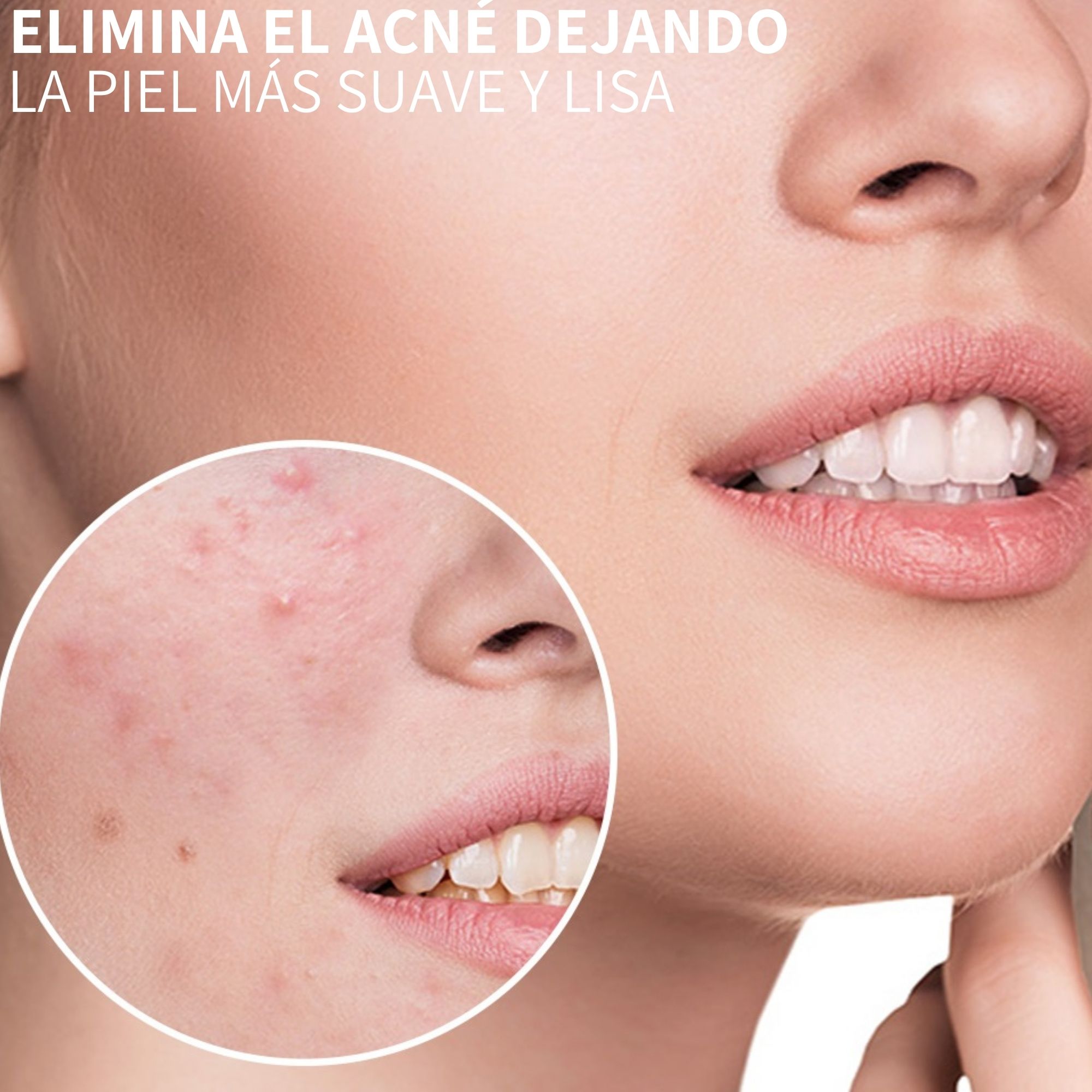 Ultrasonido Terapéutico Masajeador Antienvejecimiento