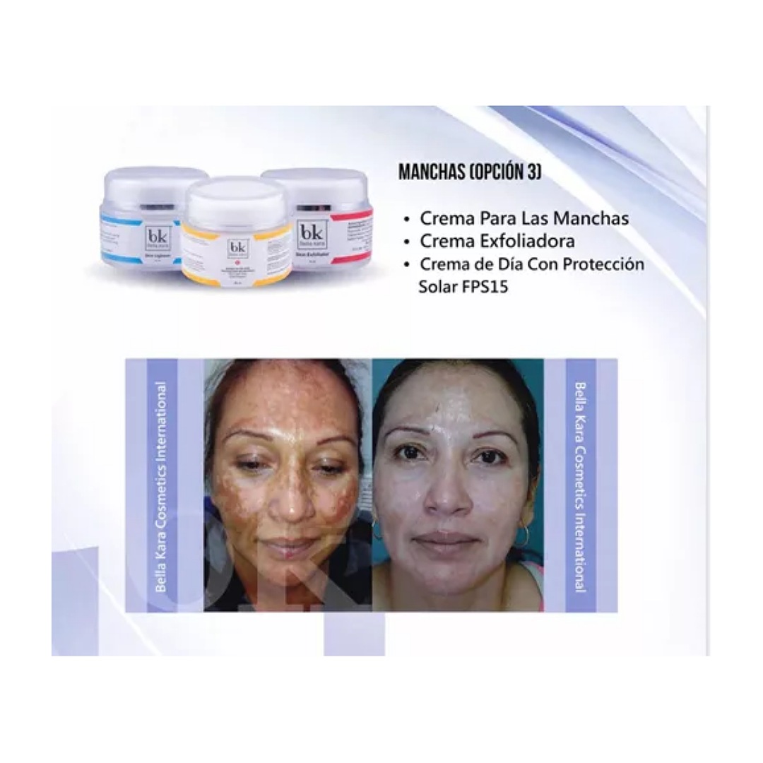 Crema bella kara para manchas alta tecnologia
